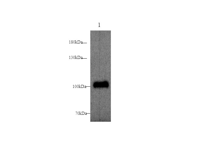 Western blot with ST14 Polyclonal antibody at dilution of 1:500.lane 1:Mouse breast