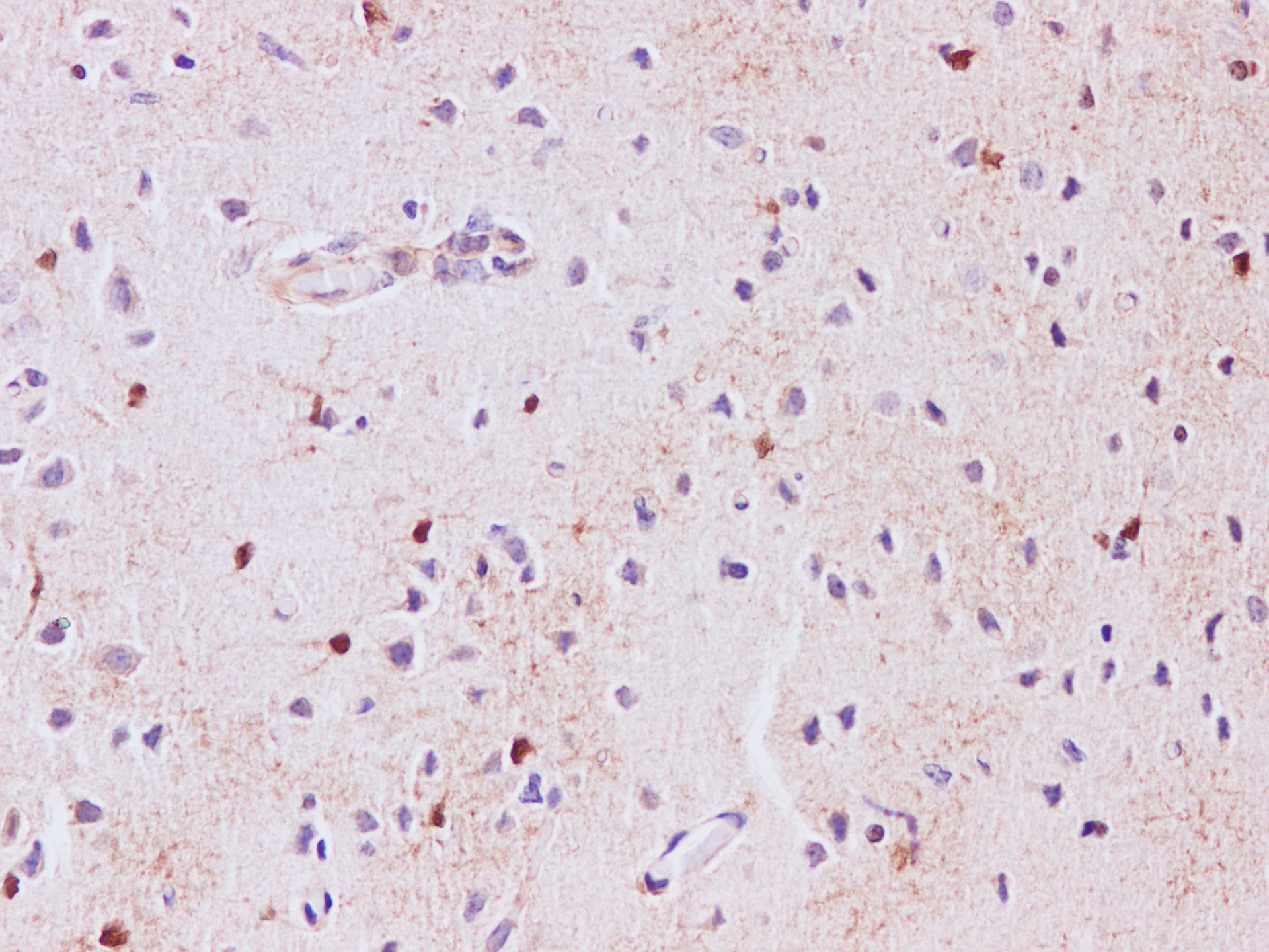 Immunohistochemistry of paraffin-embedded Rat brain using S100B Polyclonal Antibody at dilution of 1:500