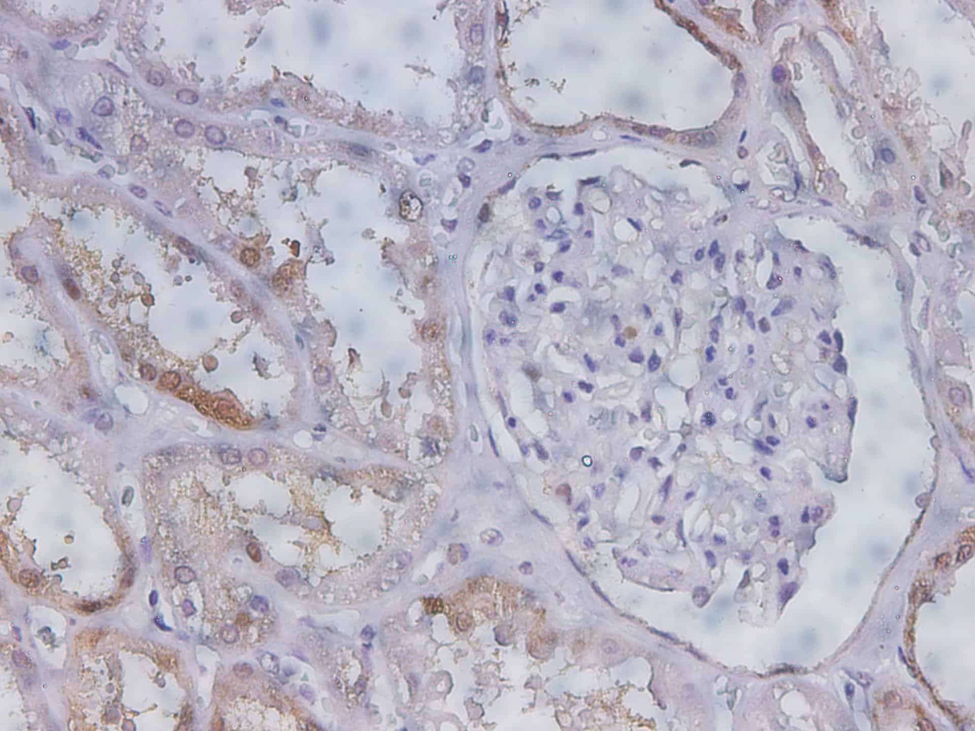 Immunohistochemistry of paraffin-embedded Human kidney using GSTP1 Polyclonal Antibody at dilution of 1:150