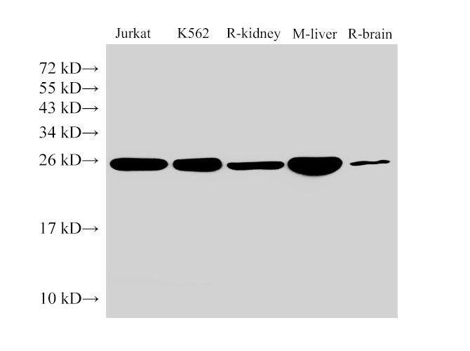 Western Blot analysis of Jurkat, K562, Rat kidney, Mouse liver and Rat brain using GSTP1 Polyclonal Antibody at dilution of 1:1000