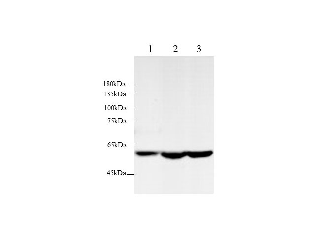 Western blot with Ampk2 Polyclonal antibody at dilution of 1:1000.lane 1:Hep G2 whole cell lysate, lane 2:Hela  whole cell lysate, lane 3:NIH/3T3 whole cell lysate
