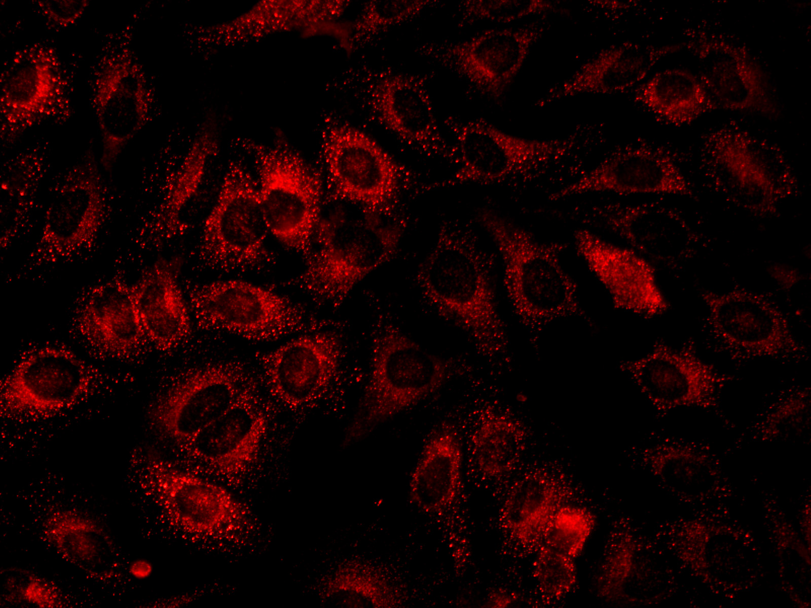 Immunofluorescence analysis of Hela cells using IFITM3 Polyclonal Antibody at dilution of 1:100