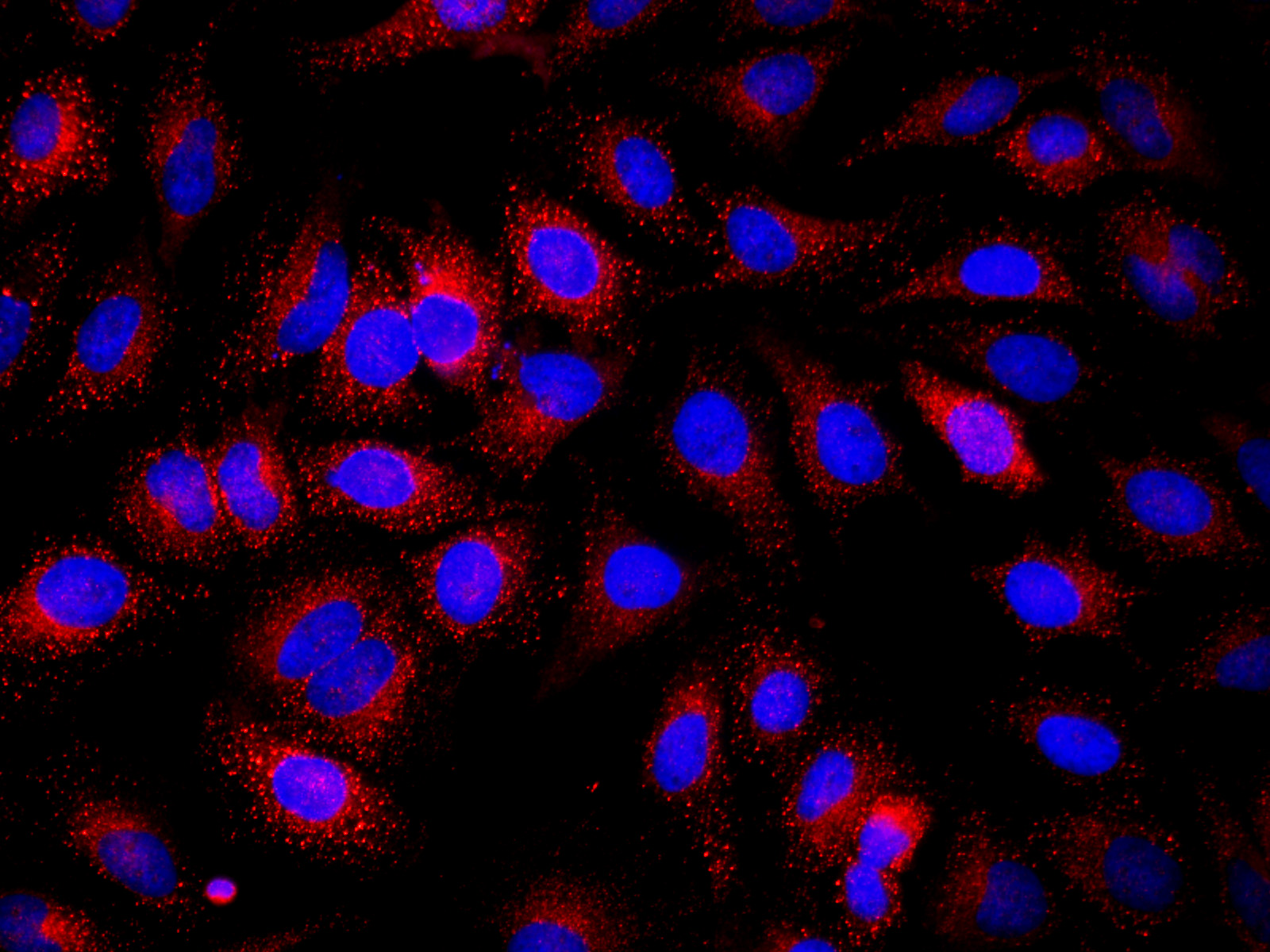 Immunofluorescence analysis of Hela cells using ifitm3 Polyclonal Antibody at dilution of 1:100