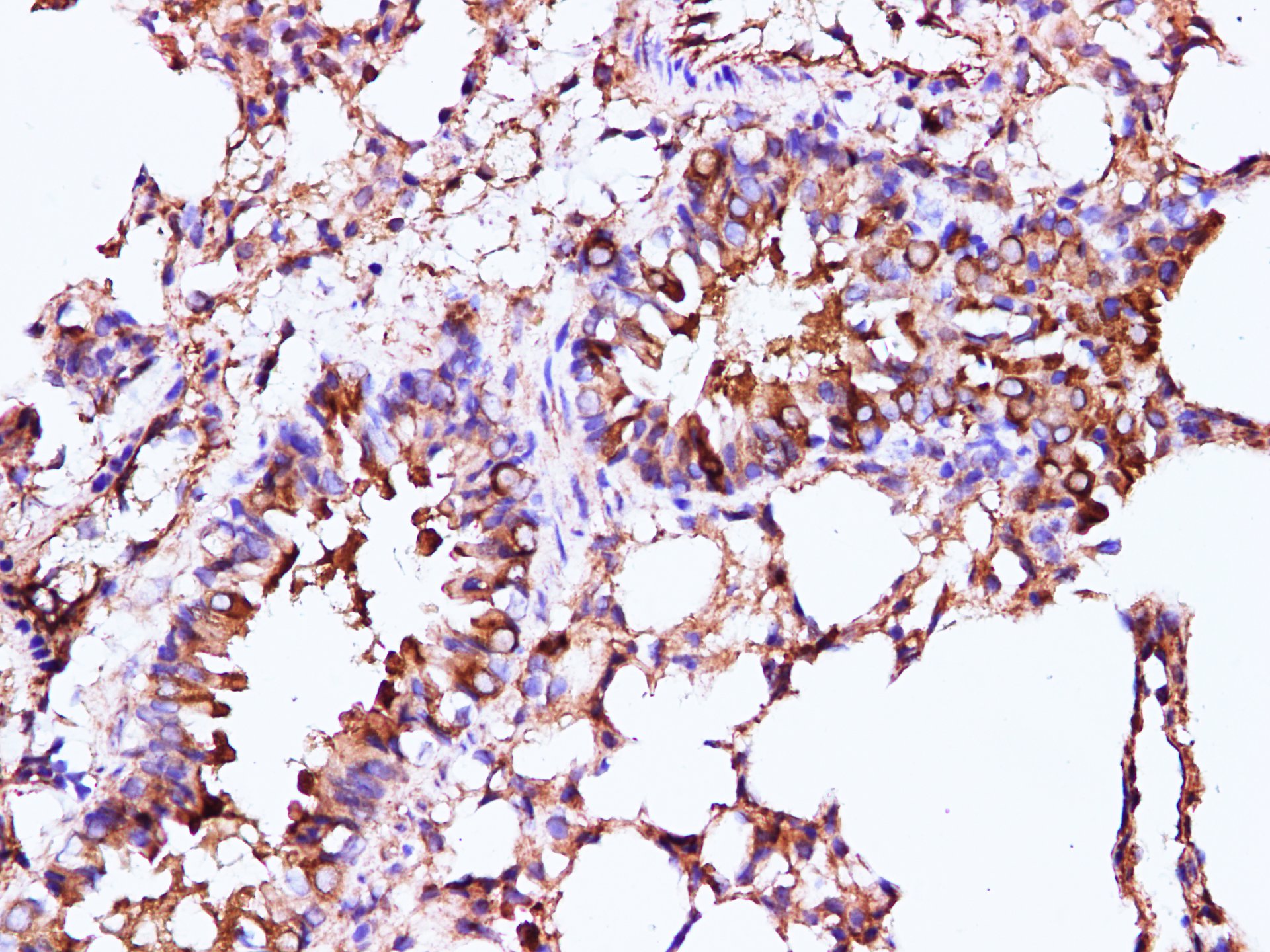 Immunohistochemistry of paraffin-embedded Mouse lung using IFITM3 Polyclonal Antibody at dilution of 1:100