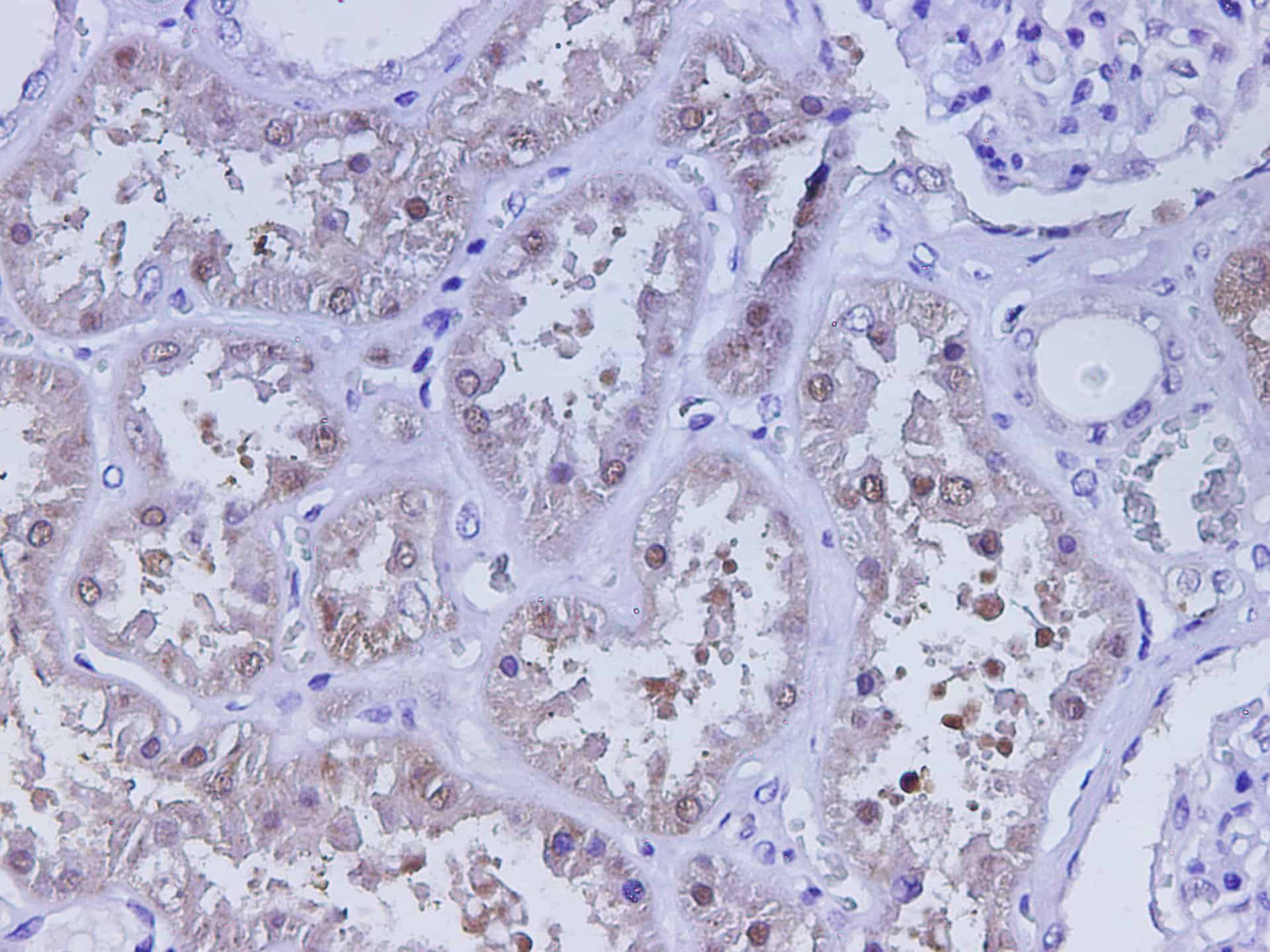 Immunohistochemistry of paraffin-embedded Human kidney using CST3 Polyclonal Antibody at dilution of 1:500