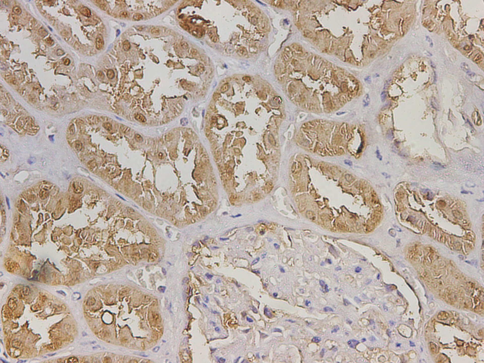 Immunohistochemistry of paraffin-embedded Human kidney tissue using GSTA1 Polyclonal Antibody at dilution of 1:450