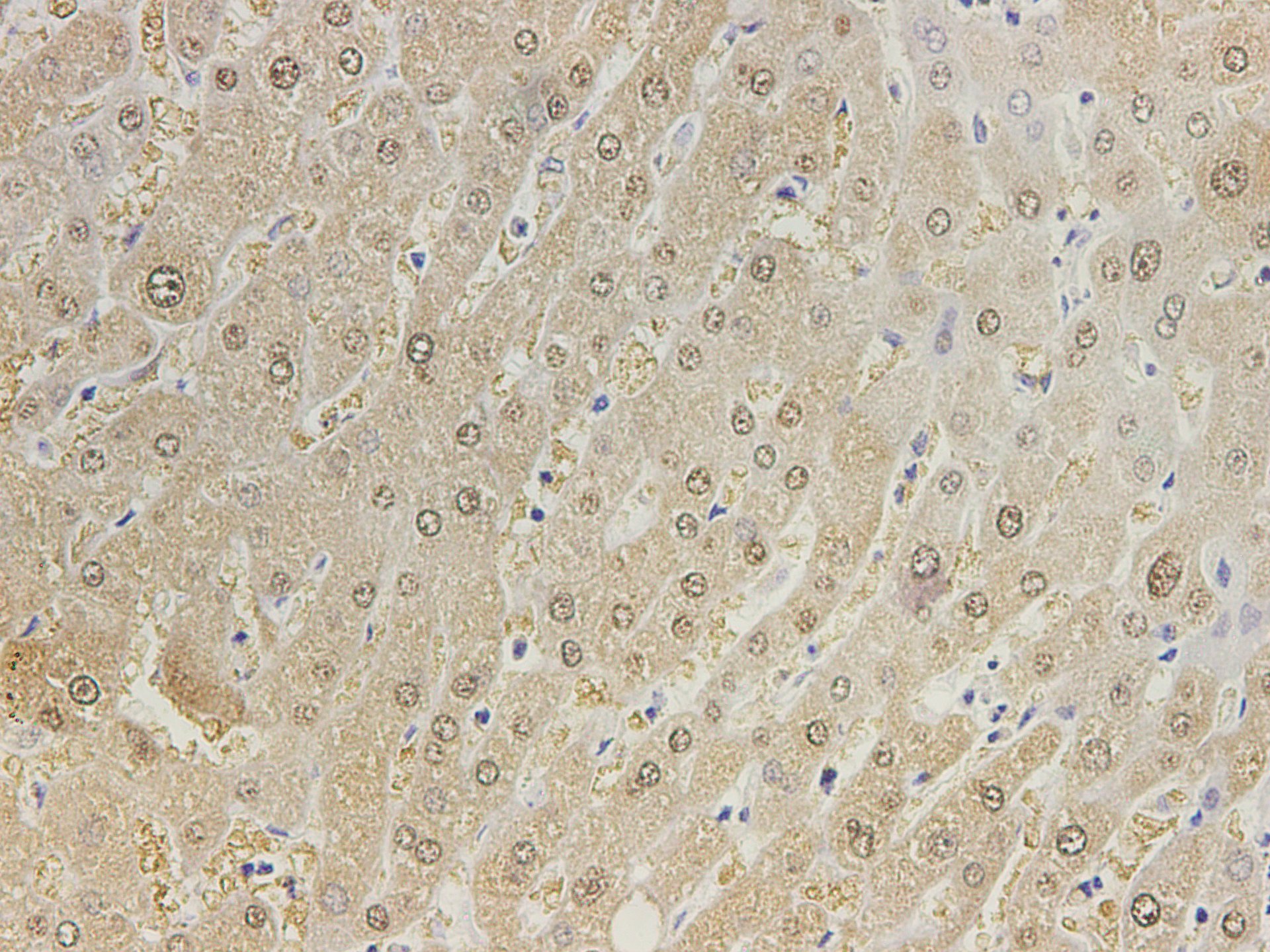 Immunohistochemistry of paraffin-embedded Human liver tissue using GSTA1 Polyclonal Antibody at dilution of 1:450