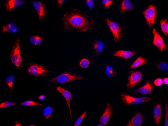 Immunofluorescence analysis of Hela cells  using CK-18 Polyclonal Antibody at dilution of 1:100