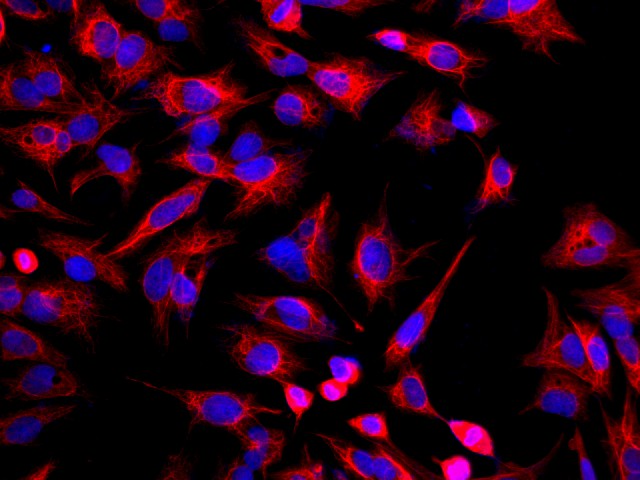 Immunofluorescence analysis of U-2OS cells  using CK-18 Polyclonal Antibody at dilution of 1:100