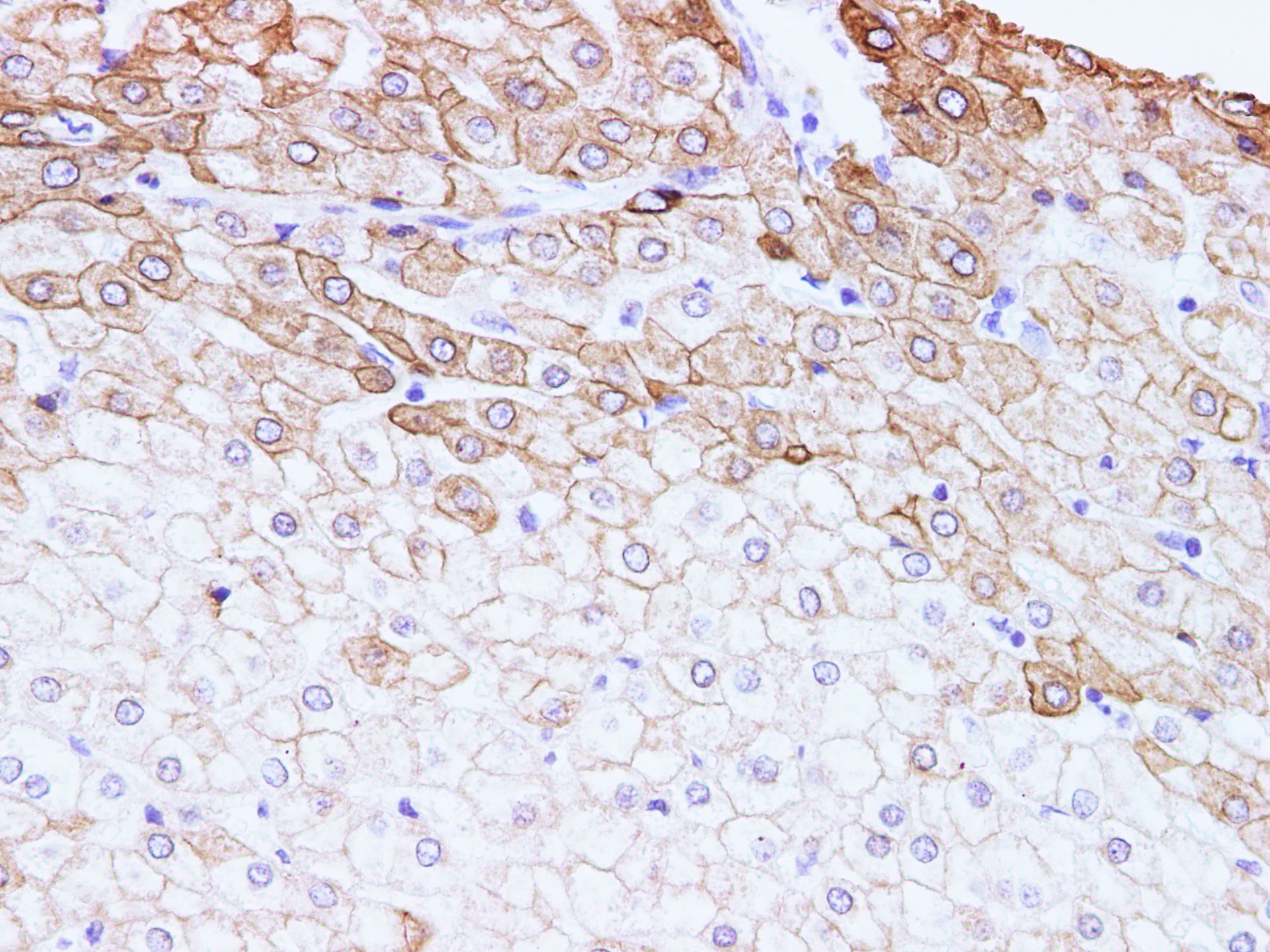 Immunohistochemistry of paraffin-embedded Human liver  using CK-18 Polyclonal Antibody at dilution of 1:100