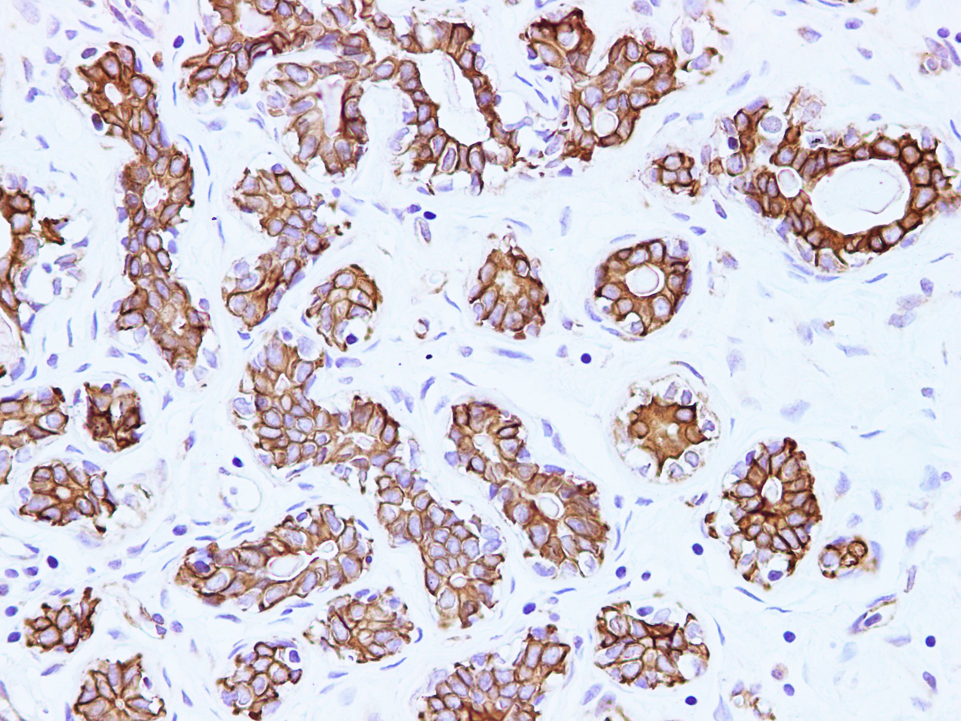 Immunohistochemistry of paraffin-embedded Human breast using CK-18 Polyclonal Antibody at dilution of 1:100