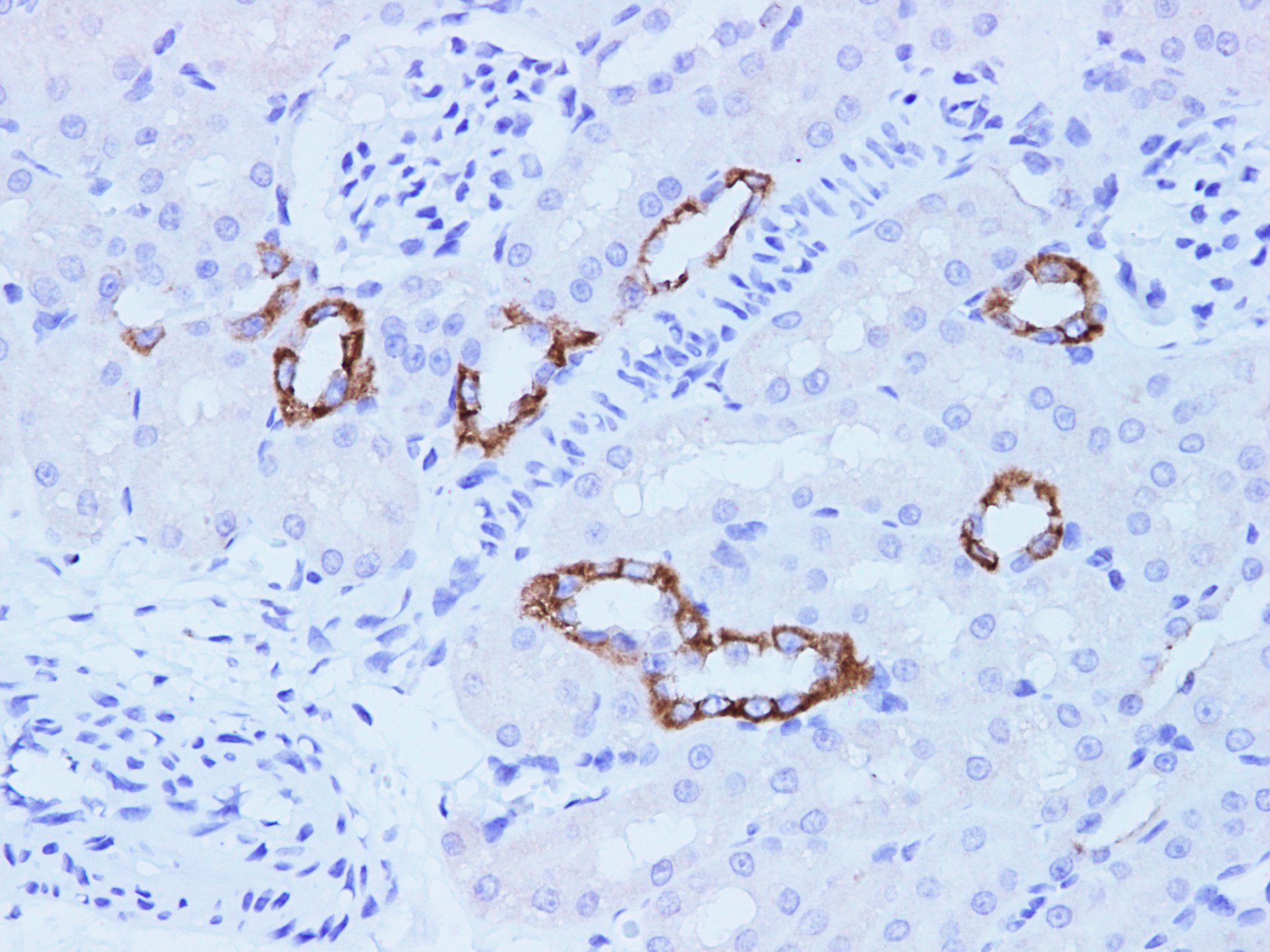 Immunohistochemistry of paraffin-embedded Rat kidney  using CK-18 Polyclonal Antibody at dilution of 1:100