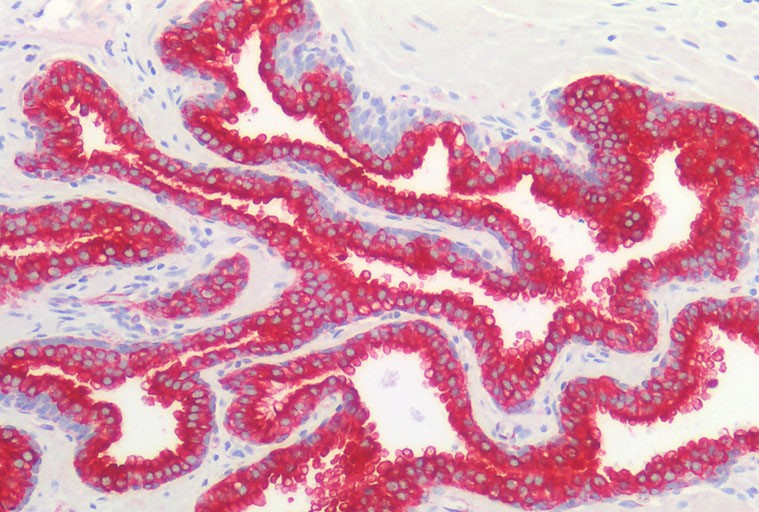 Immunohistochemistry of paraffin-embedded Human prostate using CK-18 Polyclonal Antibody at dilution of 1:100.