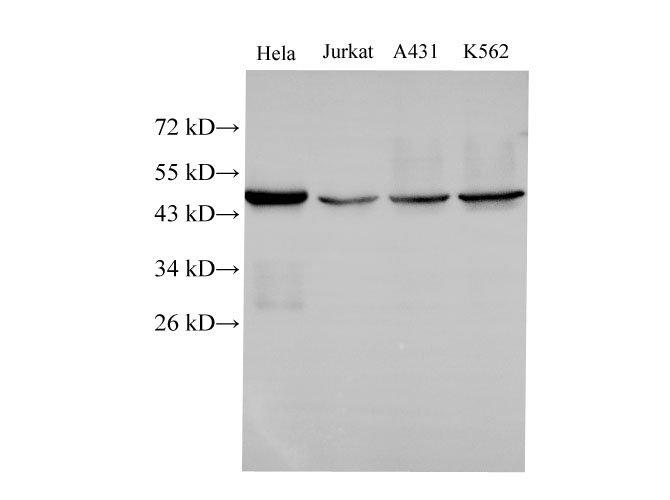 Western Blot analysis of Hela, Jurkat, A431 and k562 cells using CK-18 Polyclonal Antibody at dilution of 1:500