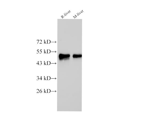 Western Blot analysis of Rat liver and Mouse liver  using CK-18 Polyclonal Antibody at dilution of 1:500