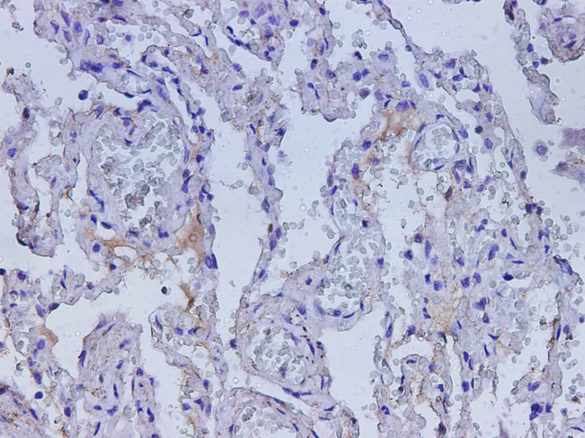 Immunohistochemistry of paraffin-embedded Human lung using Adipoq Polyclonal Antibody at dilution of 1:600