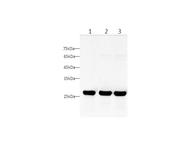 Western blot with UCHL1 Polyclonal antibody at dilution of 1:1000.lane 1:SH-SY5Y whole cell lysate, lane 2:Rat brain, lane 3:C6 whole cell lysate