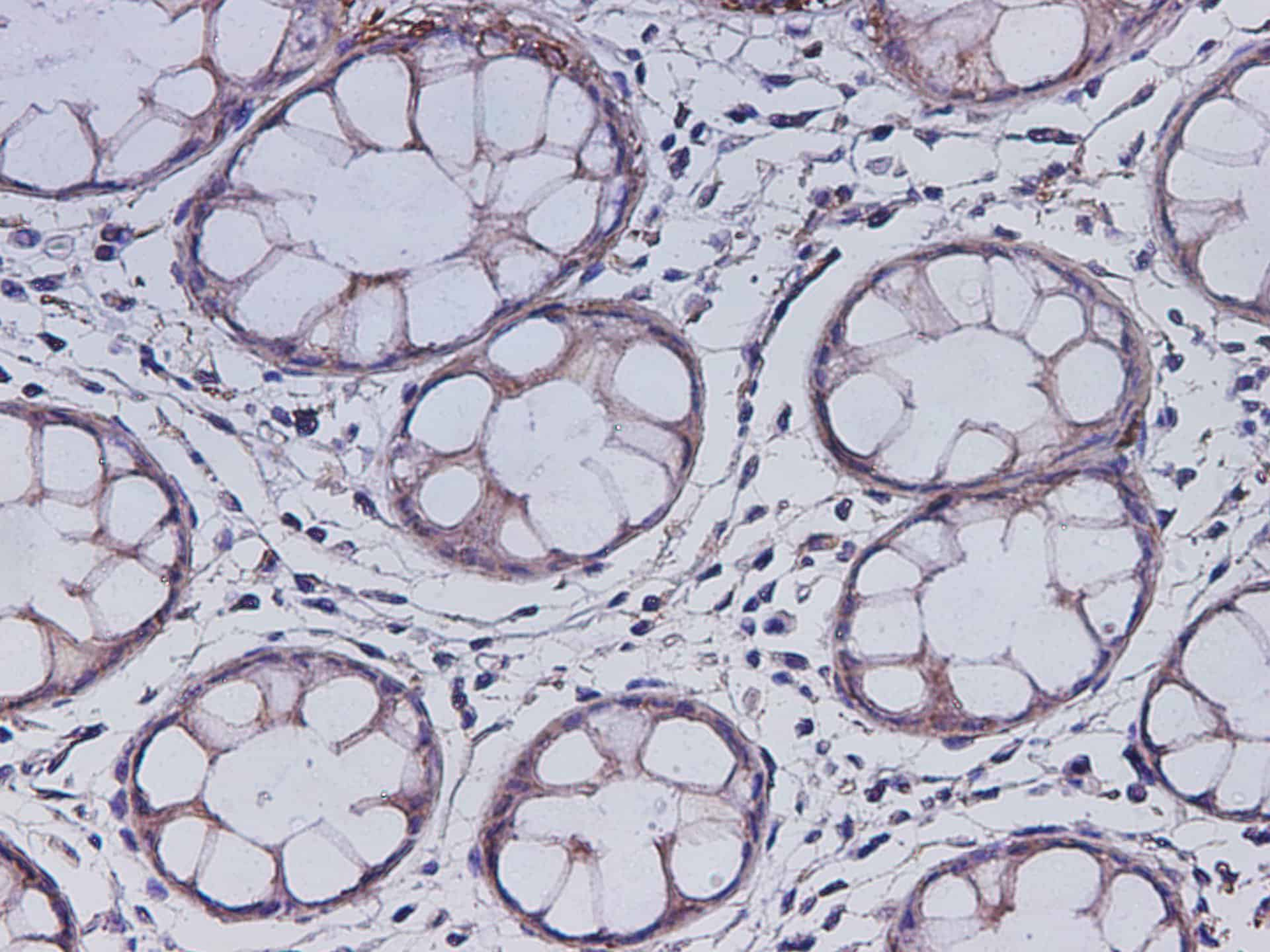 Immunohistochemistry of paraffin-embedded Mouse colon using Krt7 Polyclonal Antibody at dilution of 1:500