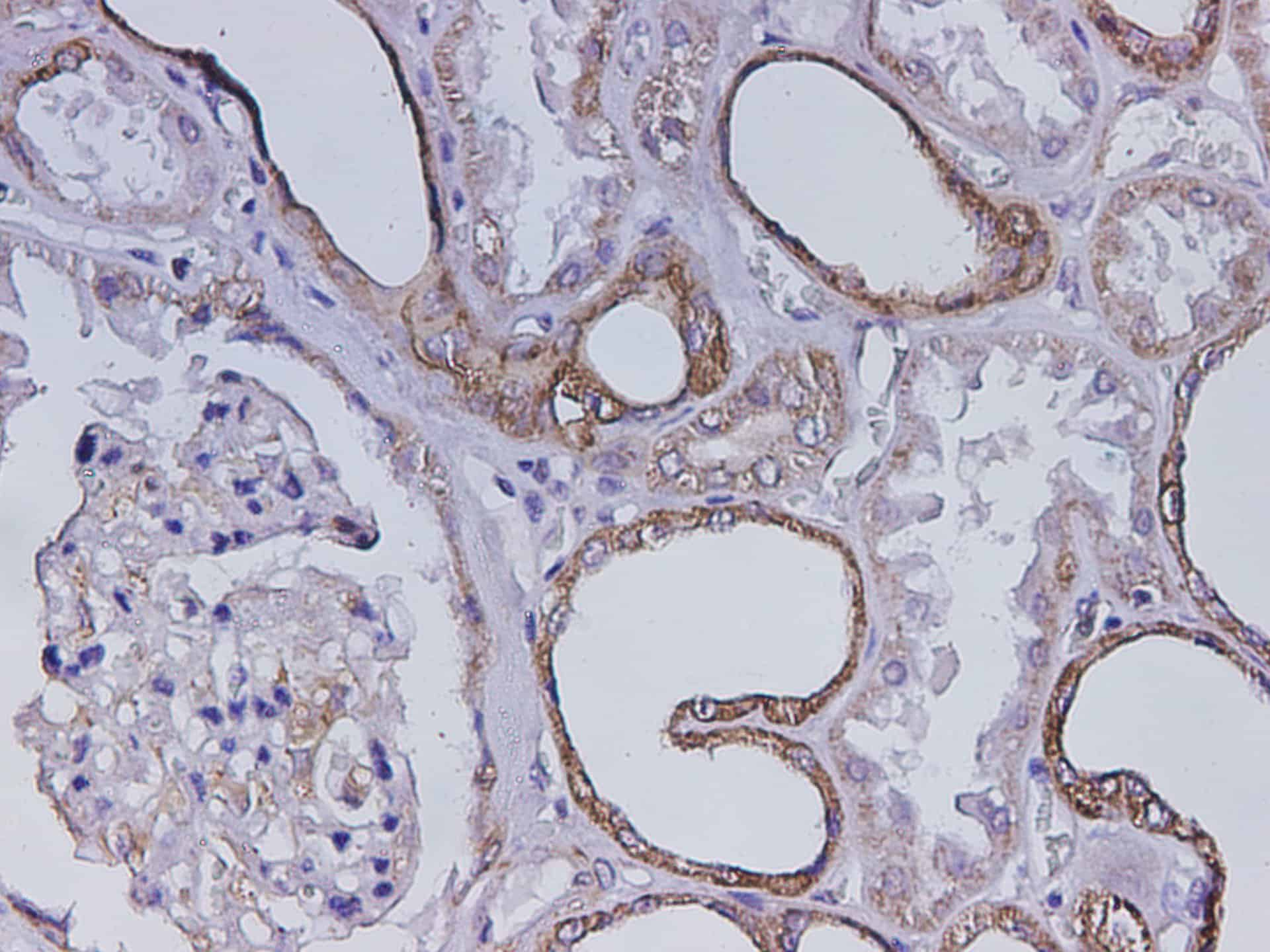 Immunohistochemistry of paraffin-embedded Mouse kidney using Krt7 Polyclonal Antibody at dilution of 1:500