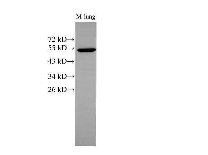 Western Blot analysis of Mouse lung using CK-7 Polyclonal Antibody at dilution of 1:500