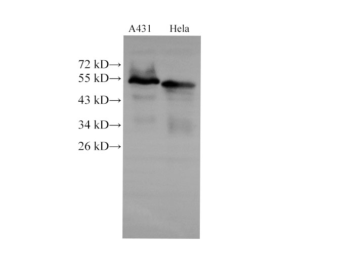 Western Blot analysis of A431 and Hela cells  using CK-7 Polyclonal Antibody at dilution of 1:2000