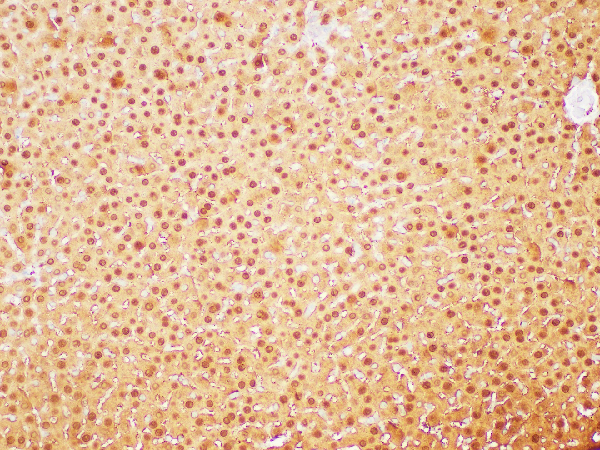 Immunohistochemistry of paraffin-embedded Rat liver using GSTA1 Polycloanl Antibody at dilution of 1:200