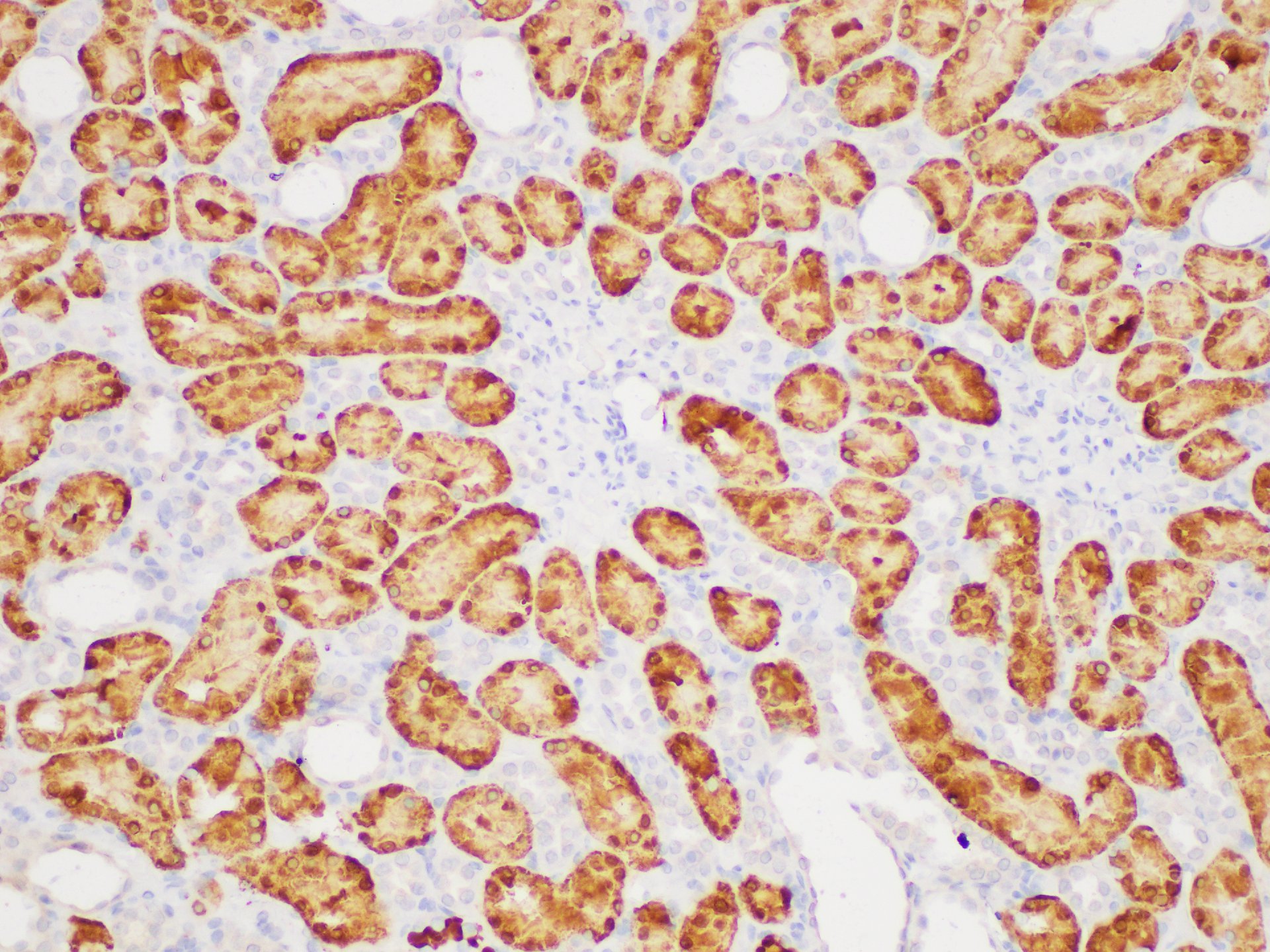 Immunohistochemistry of paraffin-embedded Rat kidney using GSTA1 Polycloanl Antibody at dilution of 1:200