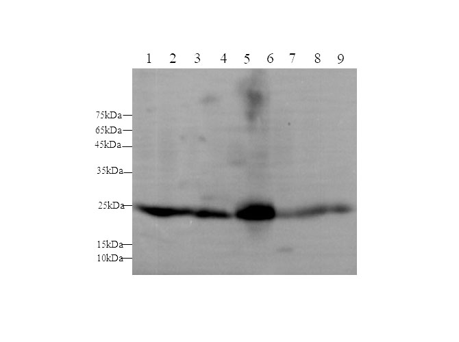 Western blot with Gsta1 Polyclonal antibody at dilution of 1:1000.lane 1:Caco-2 whole cell lysate,lane 2:Mouse liver,lane 3:Mouse testis,lane 4: Mouse kidney,lane 5:Mouse pancreas,lane 6:Rat liver,lane 7:Rat testis,lane 8: Rat kidney,lane 9:Rat pancreas