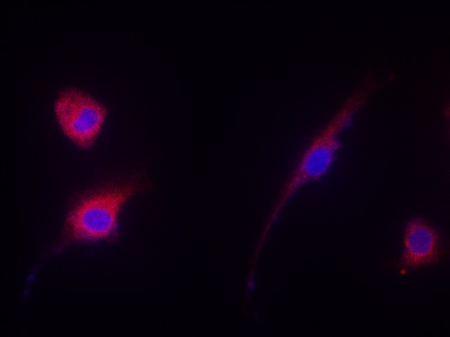 Immunofluorescence analysis of NIH/3T3 cells using EEF2 Polyclonal Antibody at dilution of 1:200