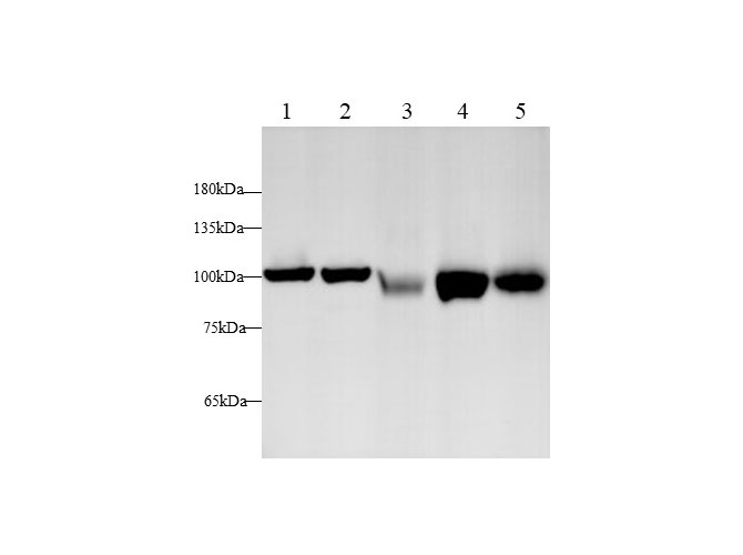 Western blot with EEF2 Polyclonal antibody at dilution of 1:500.lane 1:A431 whole cell lysate,lane 2:Hela whole cell lysate,lane 3:NIH/3T3 whole cell lysate,lane 4: C6 whole cell lysate,Lane 5：PC-12 whole cell lysate