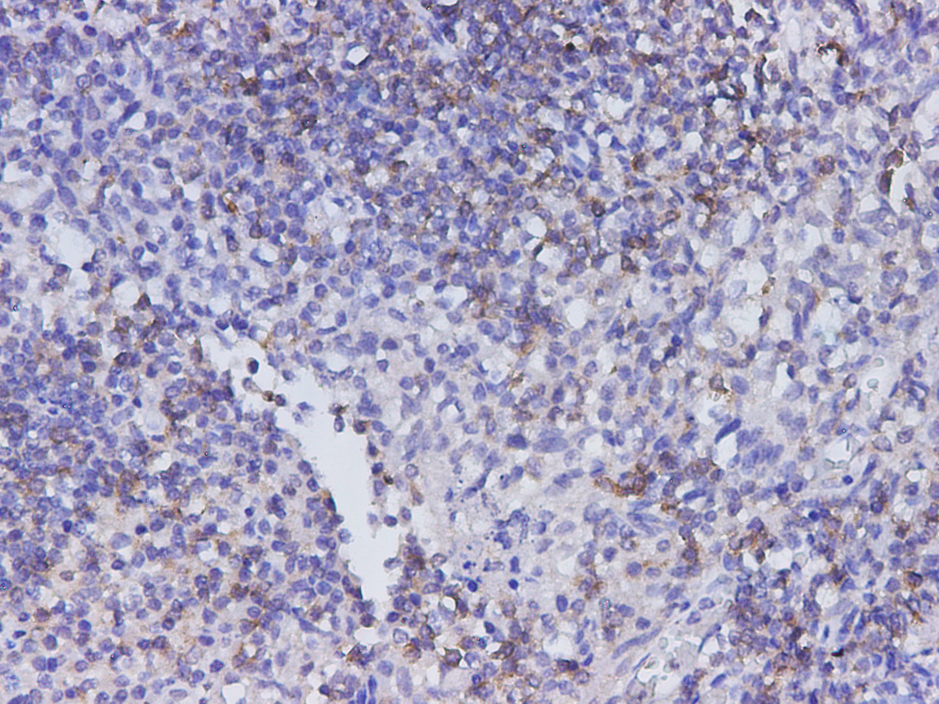 Immunohistochemistry of paraffin-embedded Human tonsil tissue using CD22 Polyclonal Antibody at dilution of 1:350