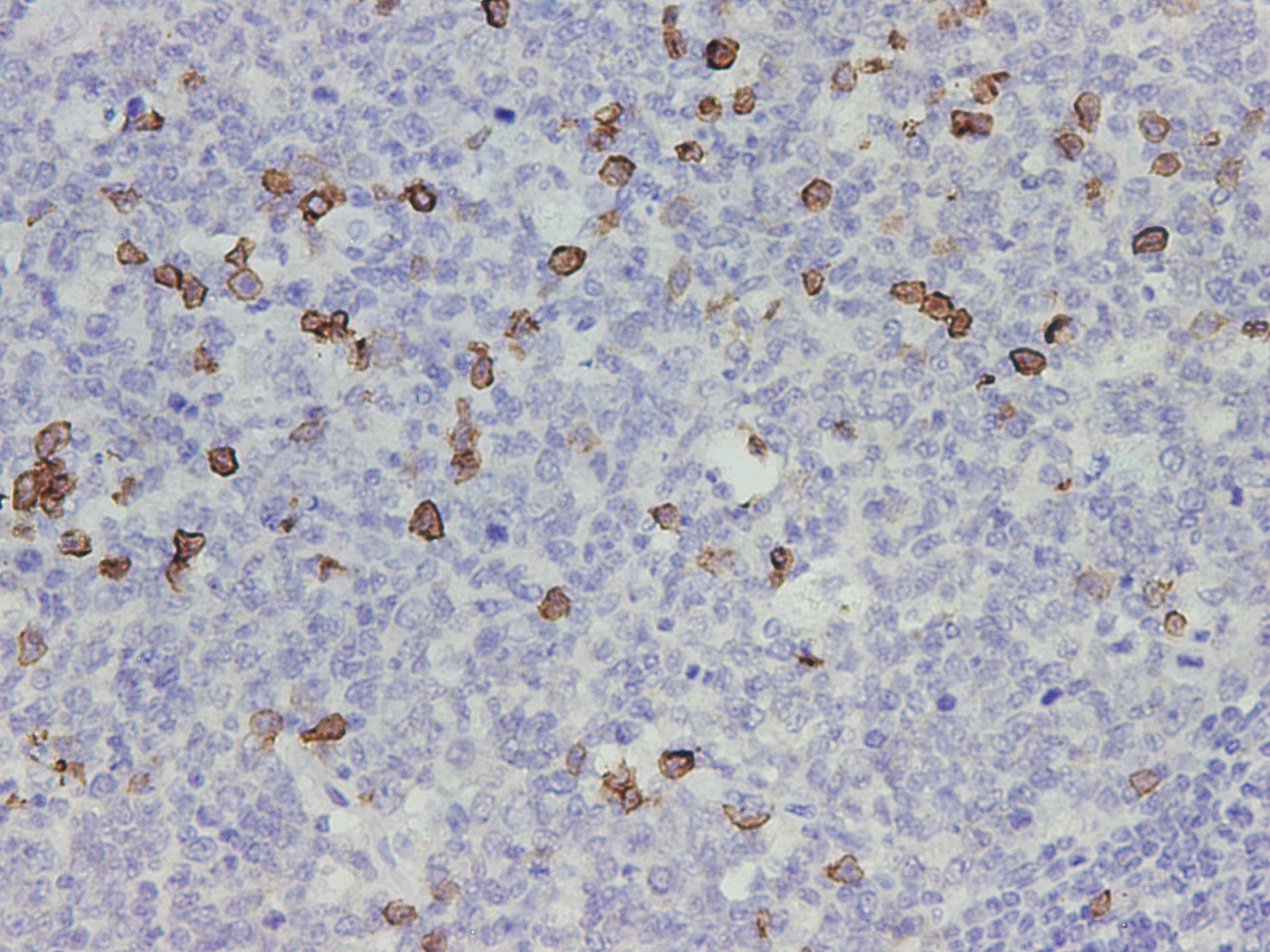 Immunohistochemistry of paraffin-embedded Human tonsil tissue using CD38 Polyclonal Antibody at dilution of 1:1000