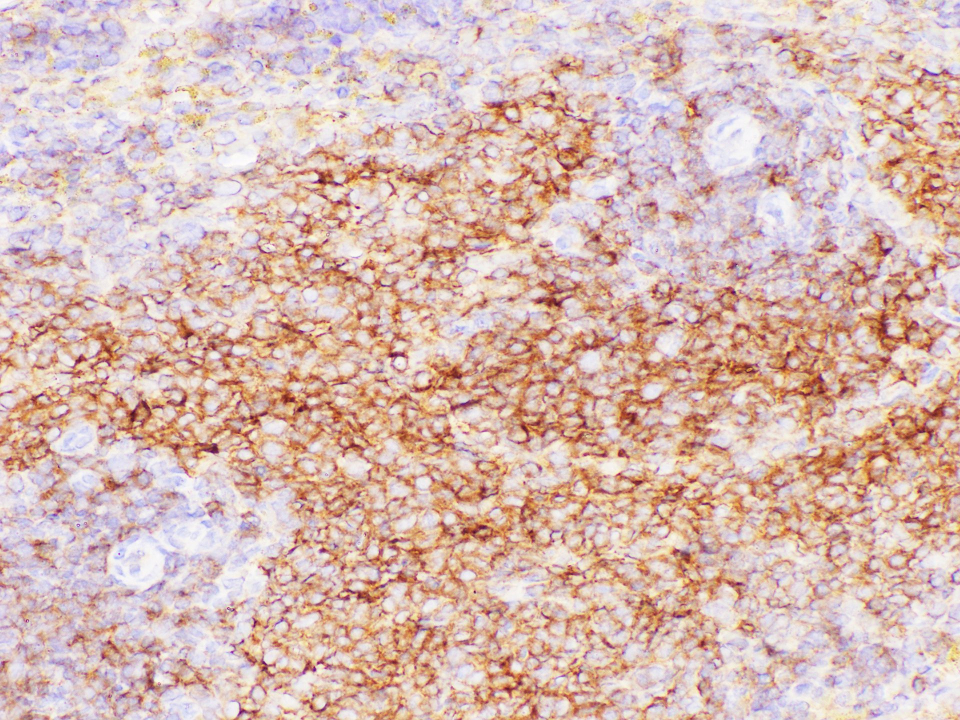 Immunohistochemistry of paraffin-embedded Rat spleen using CD38 Polycloanl Antibody at dilution of 1:200