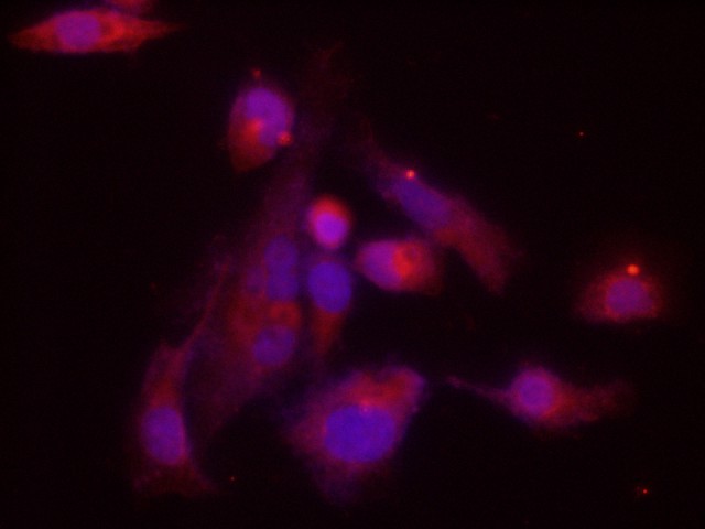 Immunofluorescence analysis of Hela cells using Mapk14 Polyclonal Antibody at dilution of 1:200