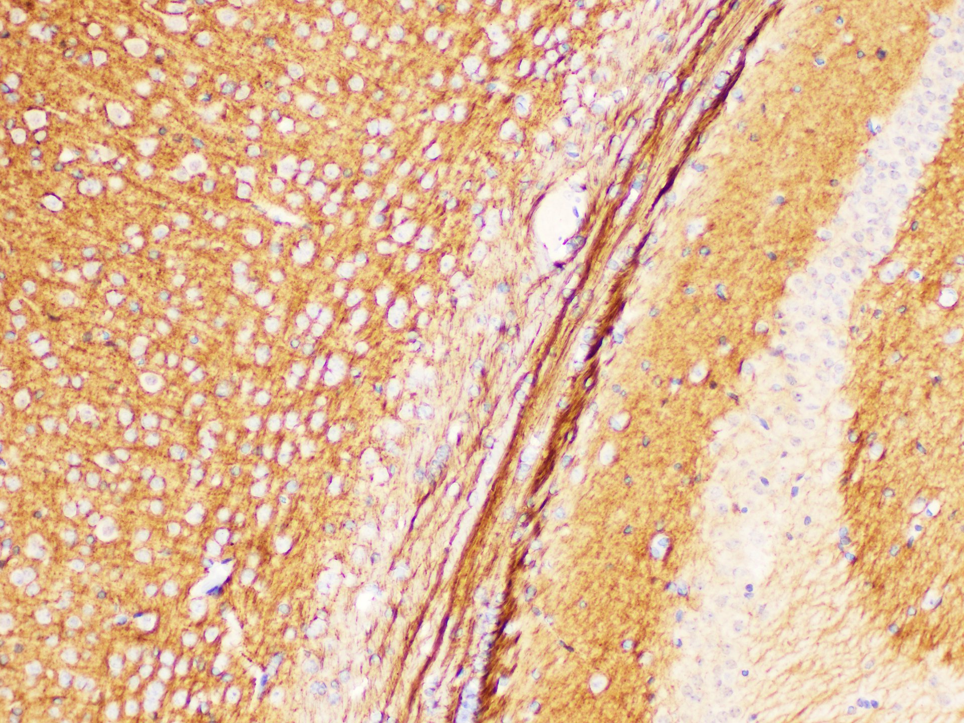 Immunohistochemistry of paraffin-embedded Mouse brain using L1CAM Polycloanl Antibody at dilution of 1:300.