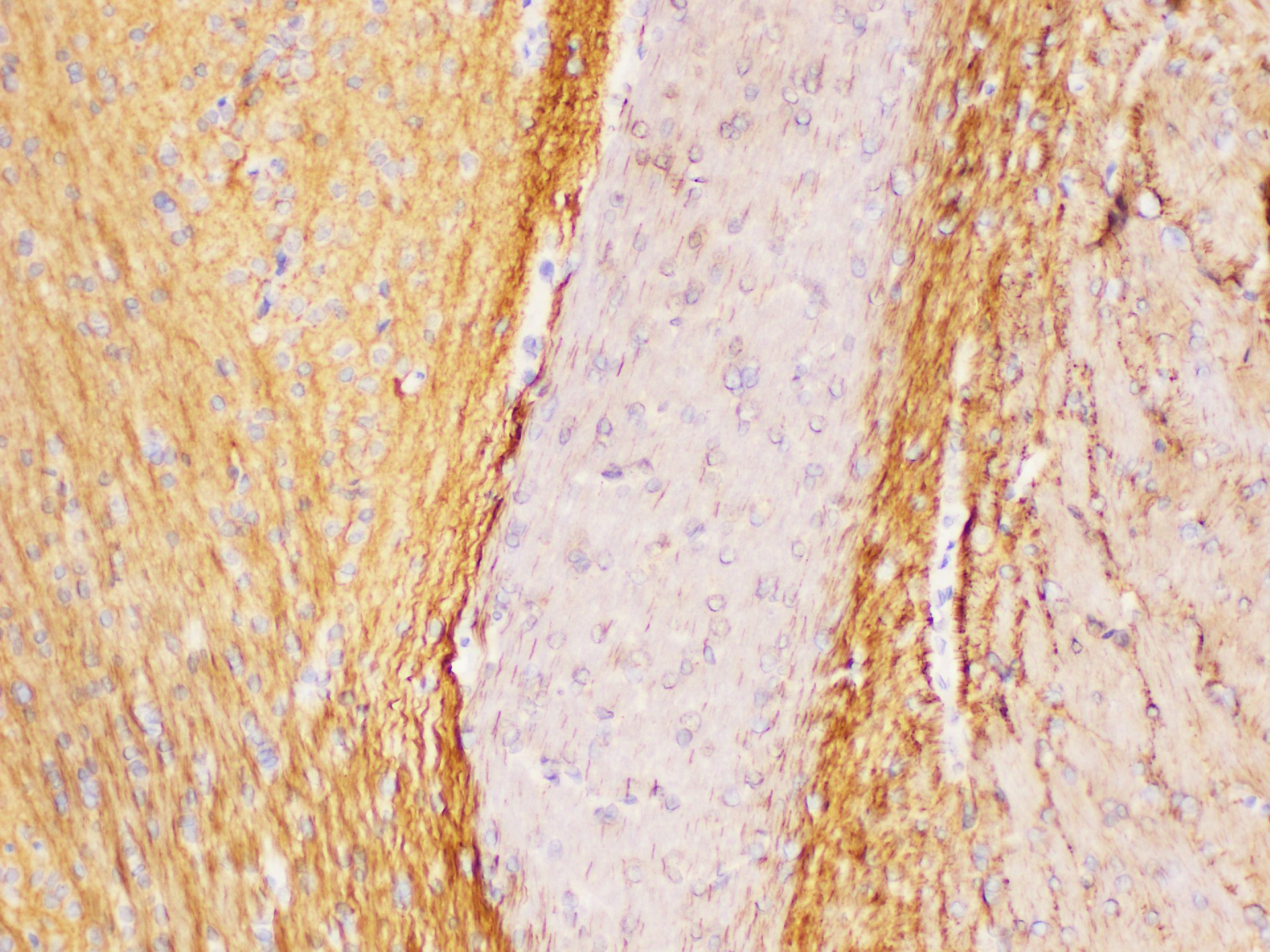 Immunohistochemistry of paraffin-embedded Rat brain using L1CAM Polycloanl Antibody at dilution of 1:300.