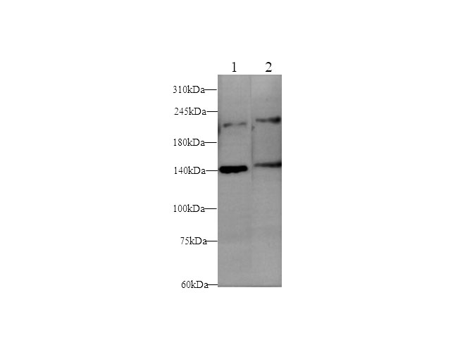 Western blot with L1cam Polyclonal antibody at dilution of 1:500.lane 1:Mouse brain,lane 2：Rat brain