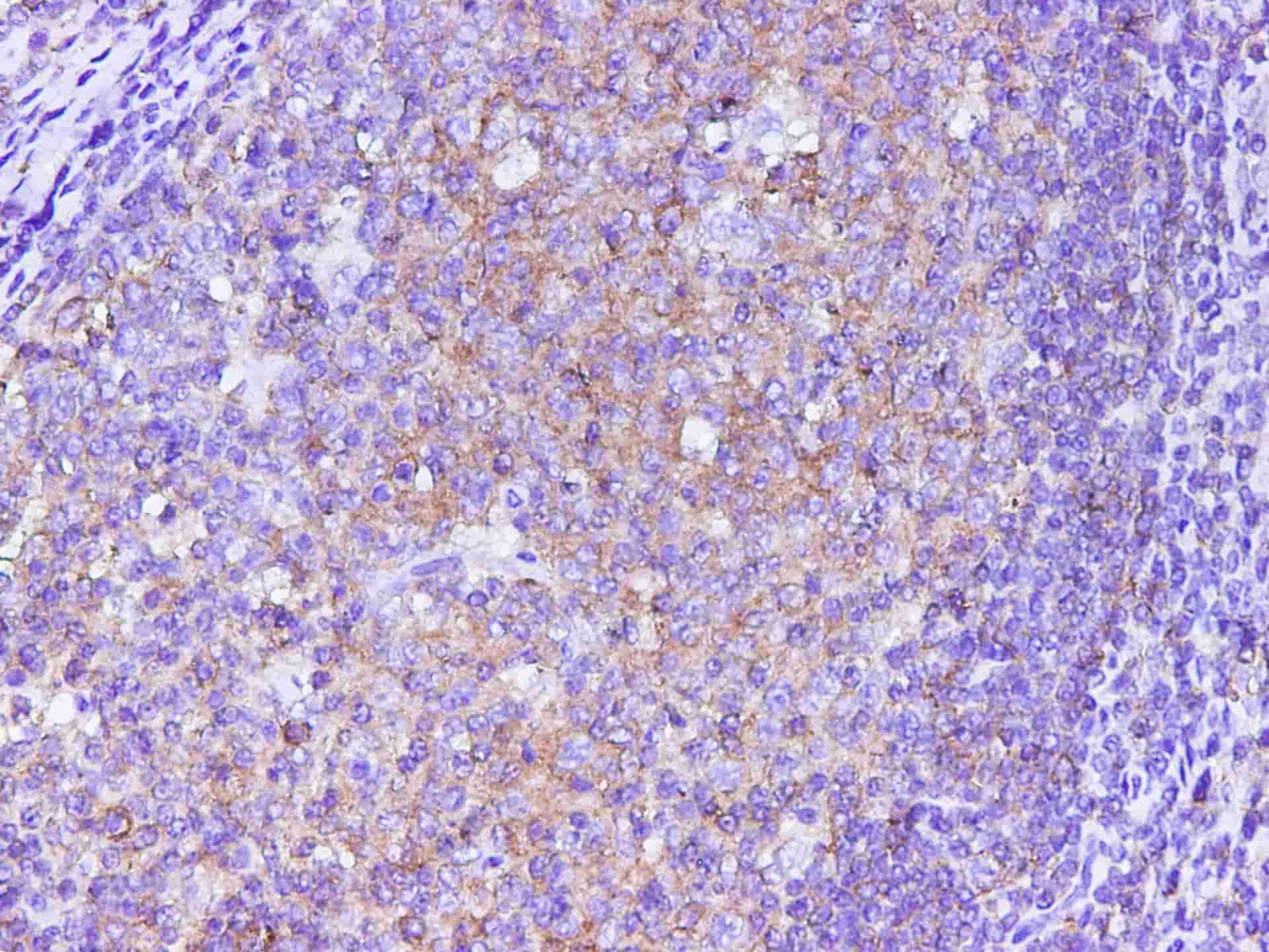 Immunohistochemistry of paraffin-embedded Human tonsil using B2M Polycloanl Antibody at dilution of 1:200