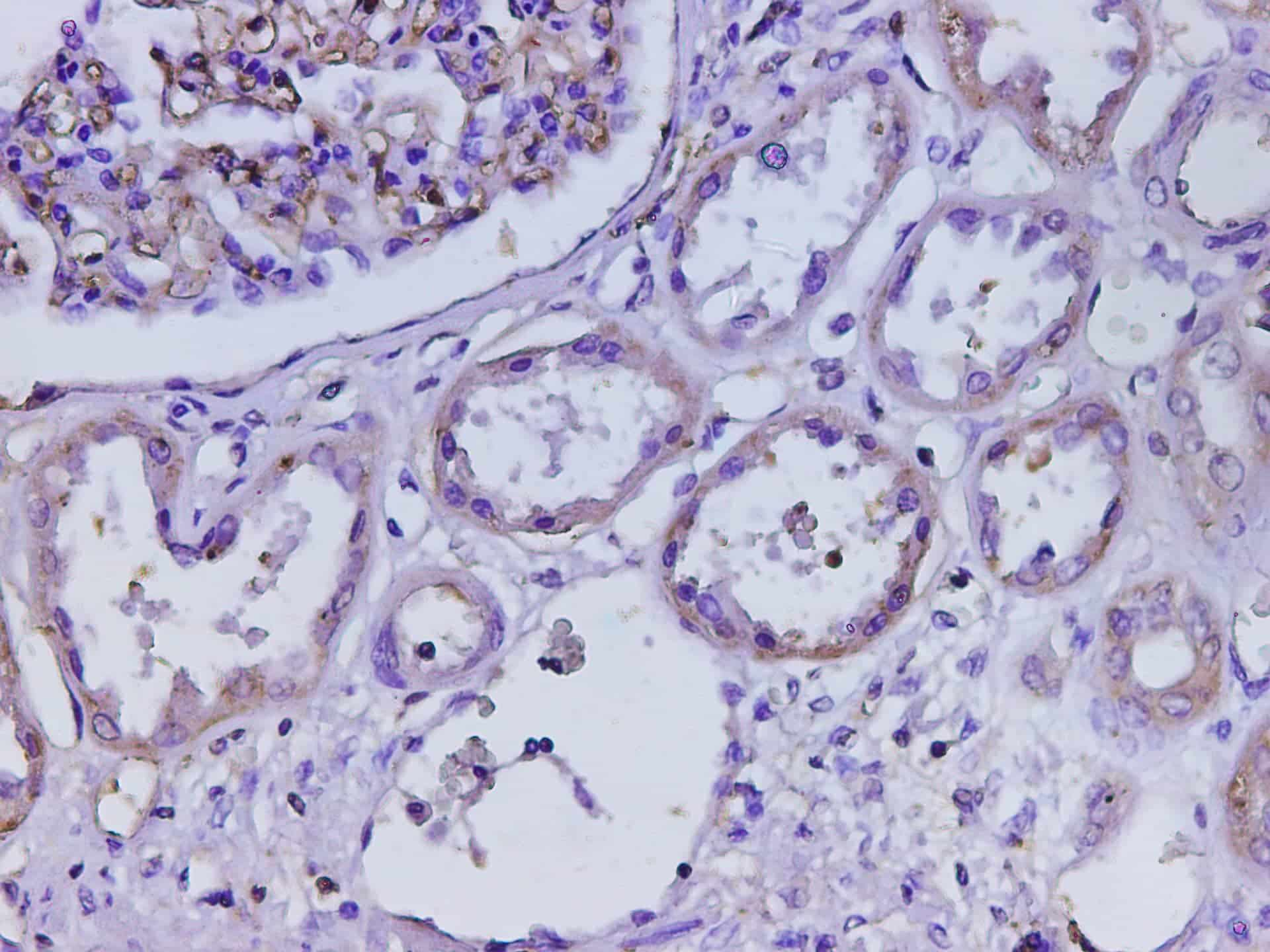 Immunohistochemistry of paraffin-embedded Human kidney using B2M Polycloanl Antibody at dilution of 1:200