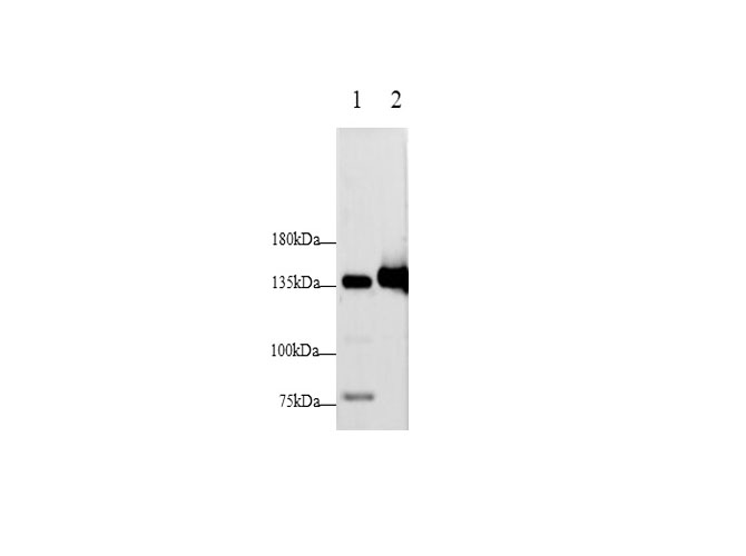 Western blot with E-Cadherin Polyclonal antibody at dilution of 1:1000.lane 1:Mouse spleen,lane 2：Rat brain