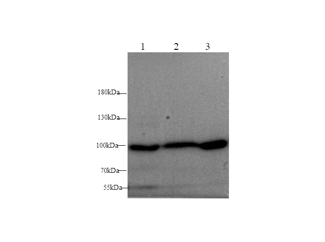 Western blot with ST14 Polyclonal antibody at dilution of 1:1000.lane 1:Mouse Kidney,lane 2:Mouse breast,lane 3: Rat Kidney