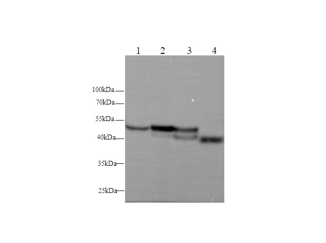 Western blot with  Serpina1 Polyclonal antibody at dilution of 1:500.lane 1:Hep G2 whole cell lysate,lane 2：Mouse kidney,lane 3：Mouse liver,lane 4：Rat kidney,lane 5：Rat liver