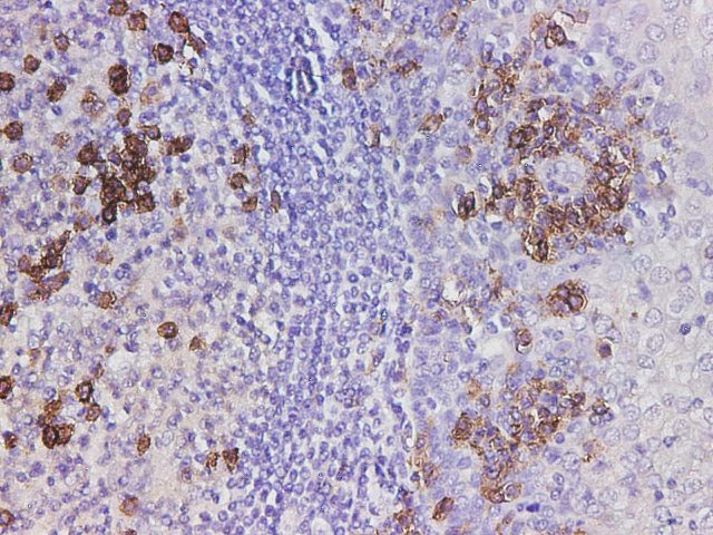 Immunohistochemistry of paraffin-embedded Human tonsil using CD38 Polyclonal Antibody at dilution of 1:5000