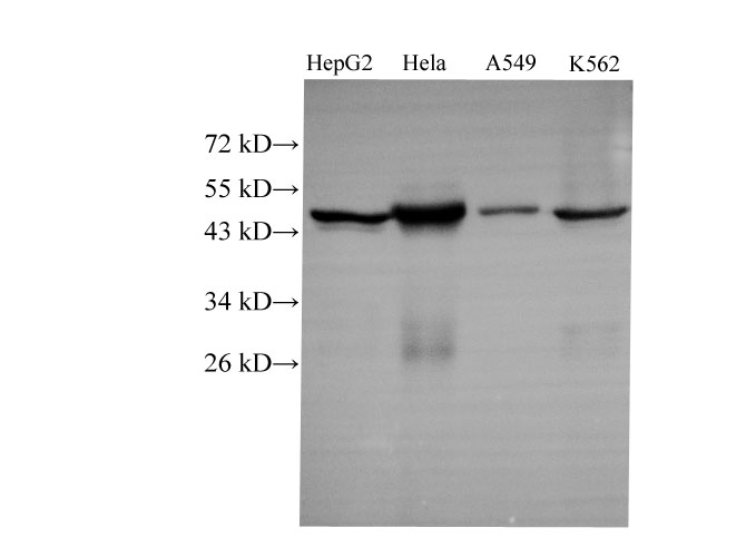 Western Blot CK-18 with Polyclonal Antibody at dilution of 1:1000. .lane 1:HepG2,lane 2:Hela, lane 3:A549,lane 4:k562