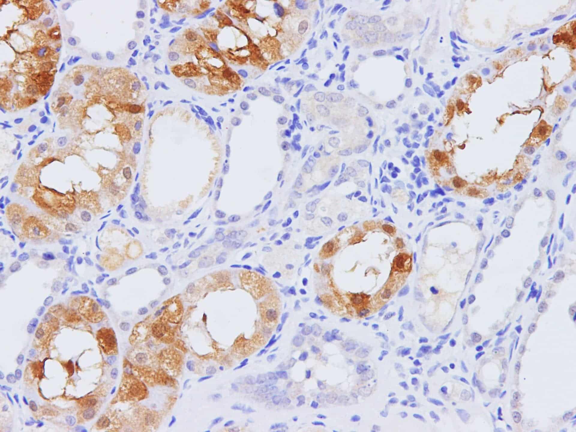 Immunohistochemistry of paraffin-embedded Rat kidney using Pck1 Polyclonal Antibody at dilution of 1:100