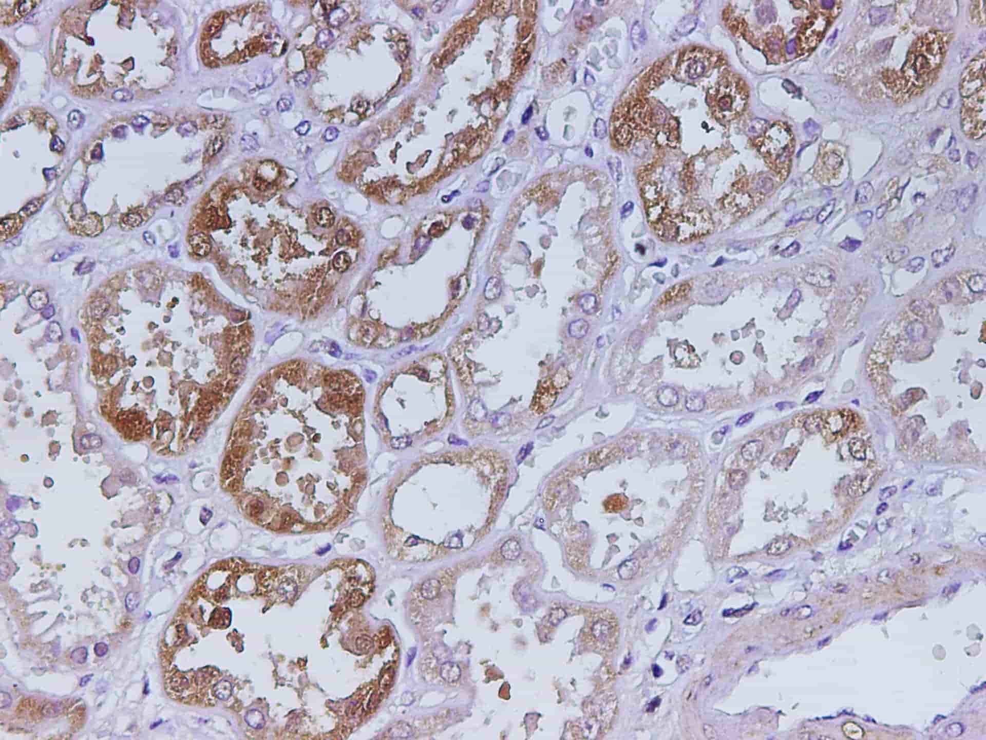 Immunohistochemistry of paraffin-embedded Human kidney using Pck1 Polyclonal Antibody at dilution of 1:200