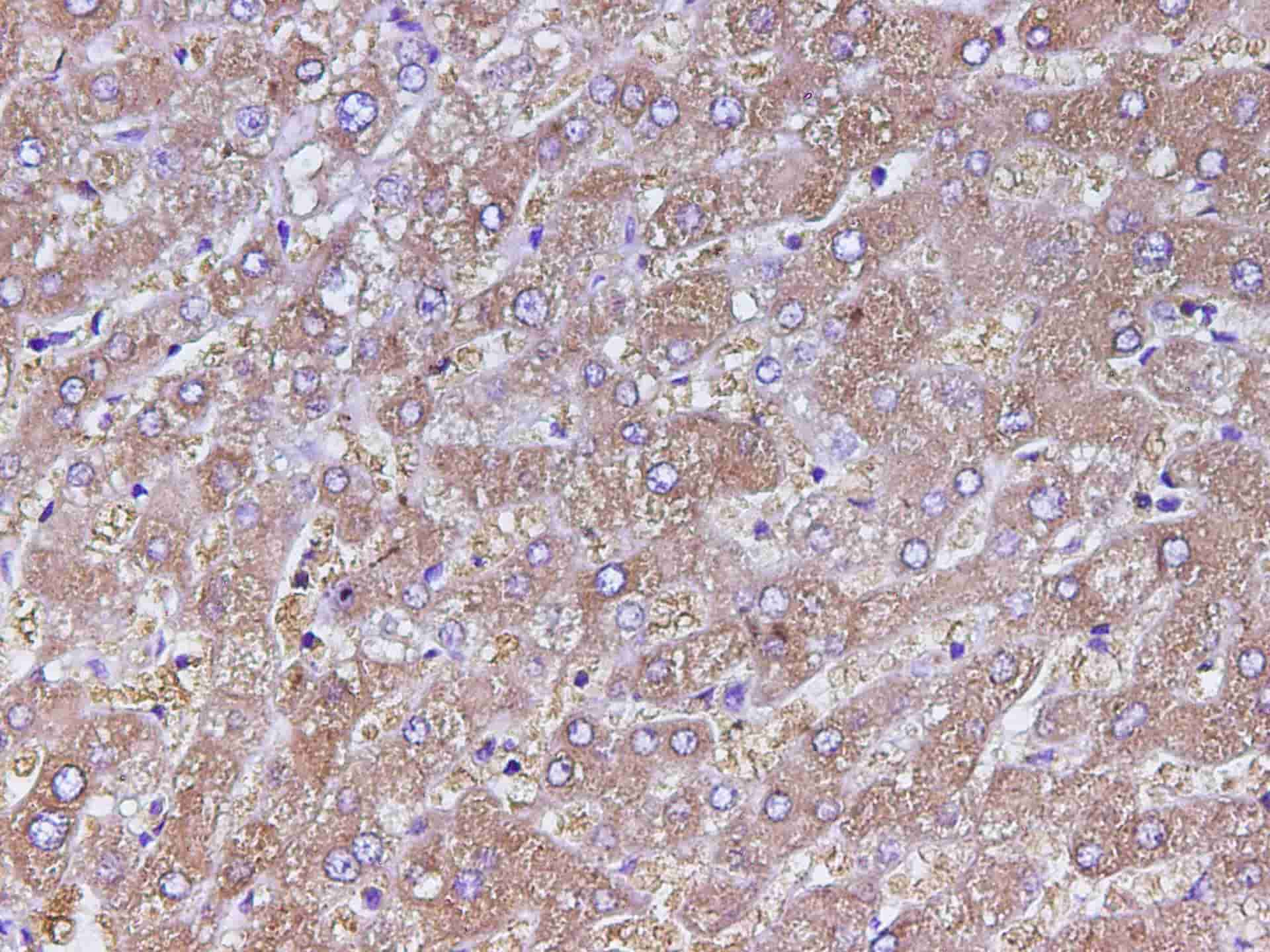 Immunohistochemistry of paraffin-embedded Human liver using PCK1 Polyclonal Antibody at dilution of 1:200