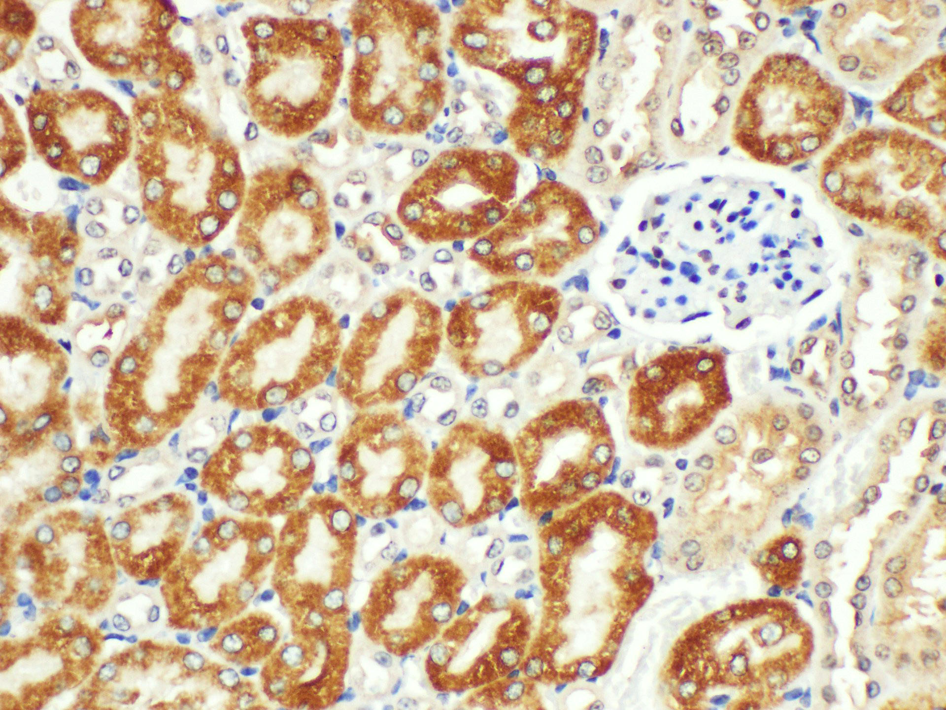 Immunohistochemistry of paraffin-embedded Mouse kidney using AMACR Polycloanl Antibody at dilution of 1:200.