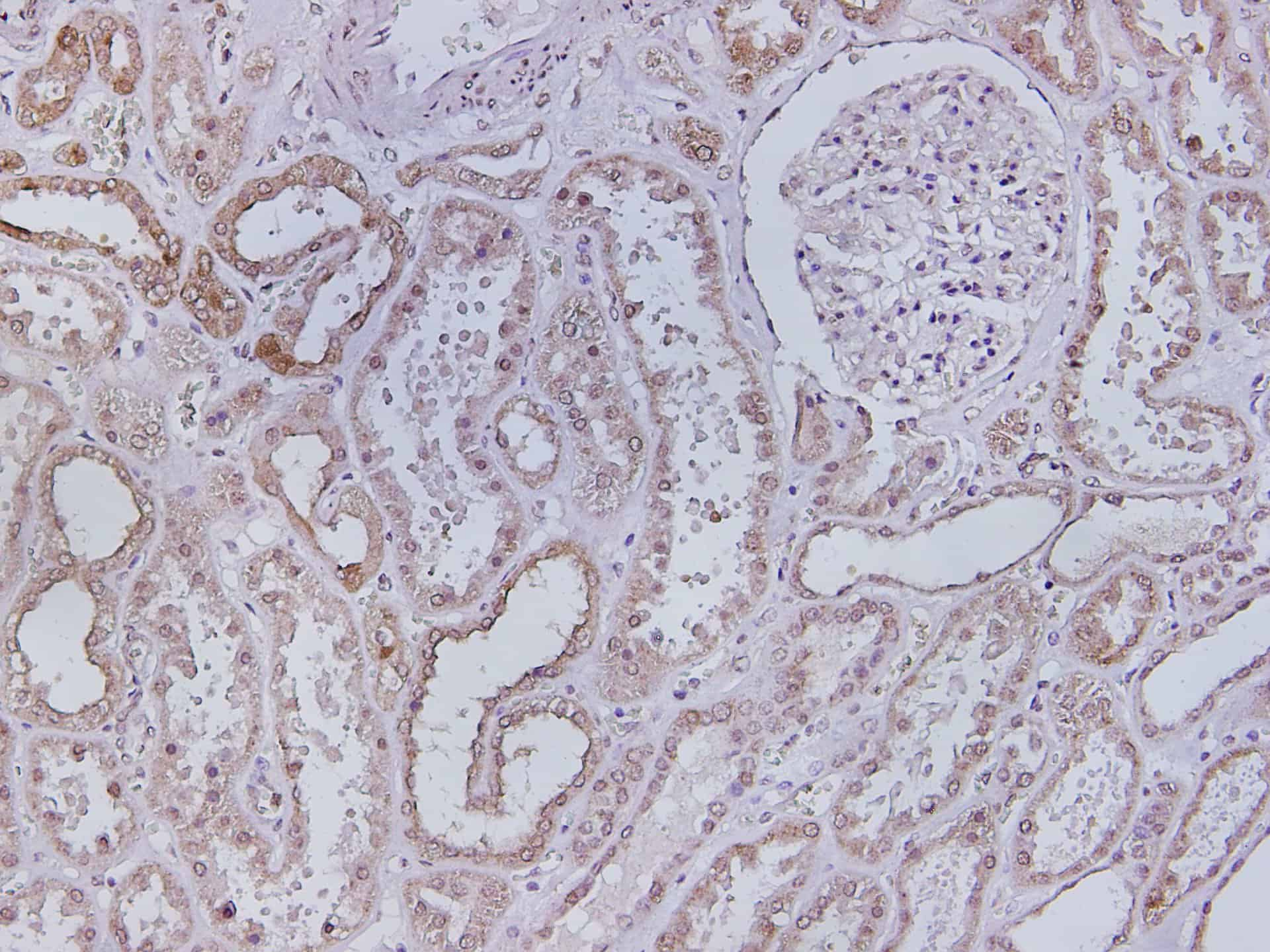 Immunohistochemistry of paraffin-embedded Human kidney using Amacr Polyclonal Antibody at dilution of 1:300