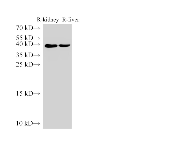 Western Blot analysis of Rat kidney and Rat liver using AMACR Polyclonal Antibody at dilution of 1:3000.
